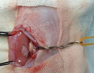 【动物造模】-硫代乙酰胺(TAA)诱发肝衰竭模型