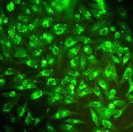 一种荧光试剂 能让癌干细胞“现身”