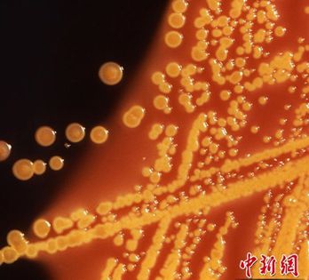 超级细菌可抵抗所有已知抗生素