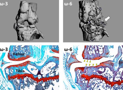 Omega 3脂肪酸减轻小鼠骨关节炎严重程度