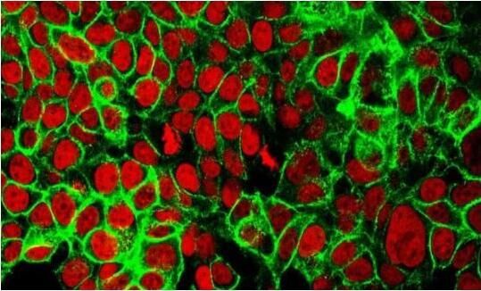 【动物造模】-如何建立小鼠模型用于疫苗研究