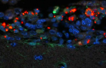 【动物造模】-如何建立沙门氏菌脑膜炎模型？