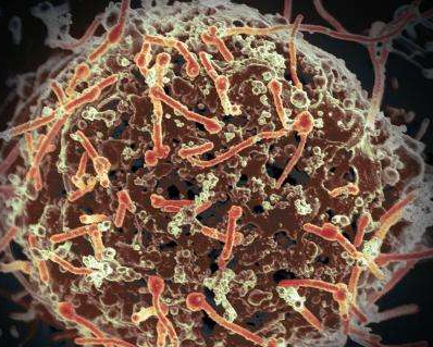 通过动物造模技术表明巨细胞病毒疫苗对埃博拉病毒有效