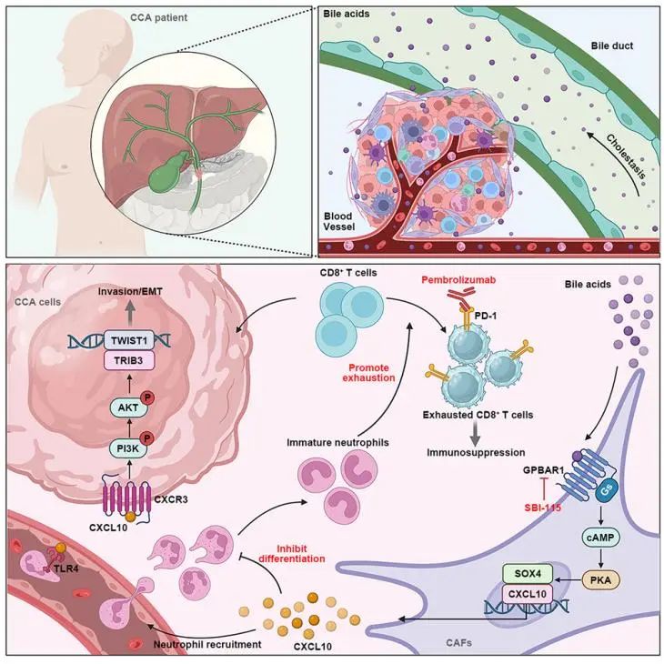 IF44.5！山东大学齐鲁医院团队重磅突破：破解胆管癌免疫耐药新机制
