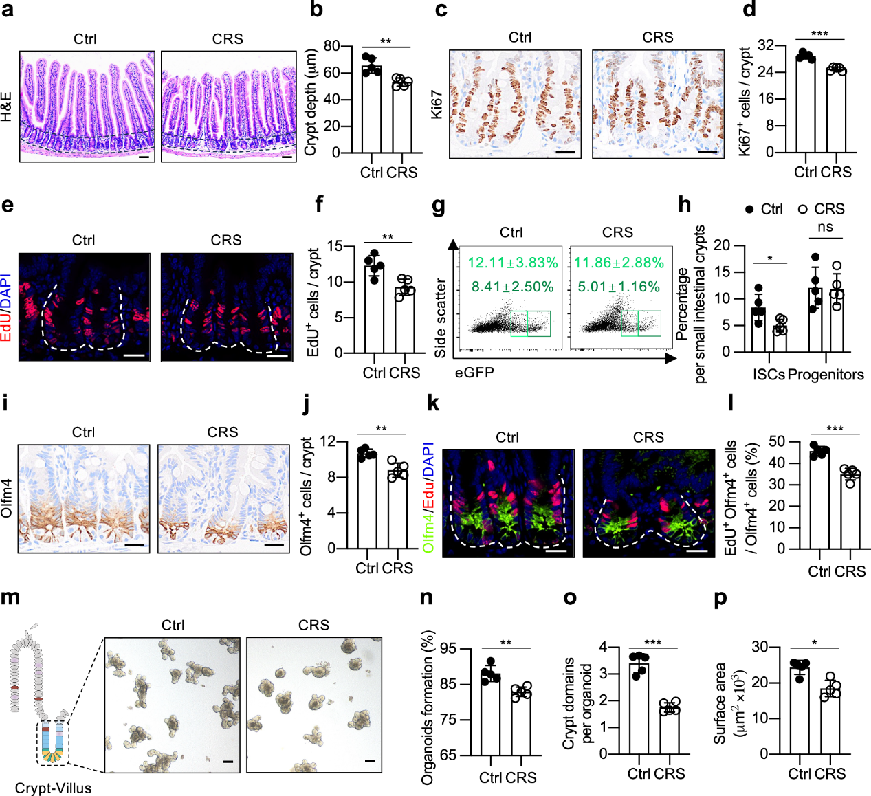国自然创新方向探索：以肠 - 脑轴新通路为核心，揭示心理应激对肠道稳态的调控机制